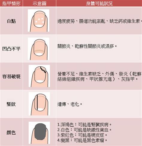 指甲內凹|指甲上有白點、凹溝暗示什麼疾病？最完整！15個指甲。